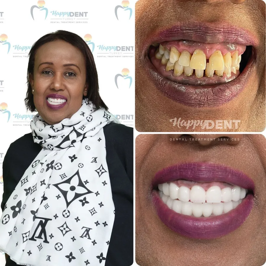 Real patients. Real transformations.